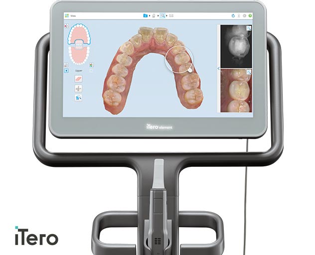 iTero element 5D